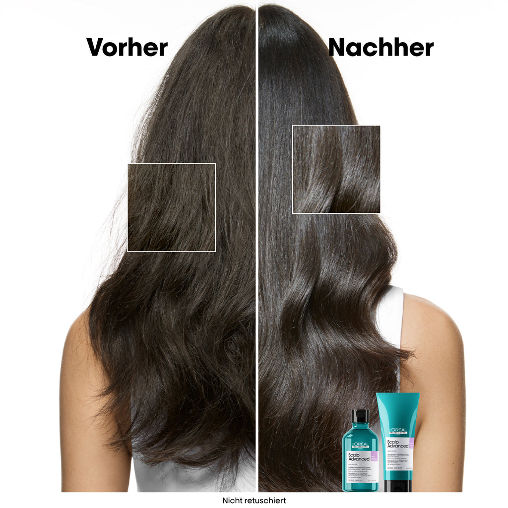 L'Oreal SE Sca A-Discf Shp 300 VB98