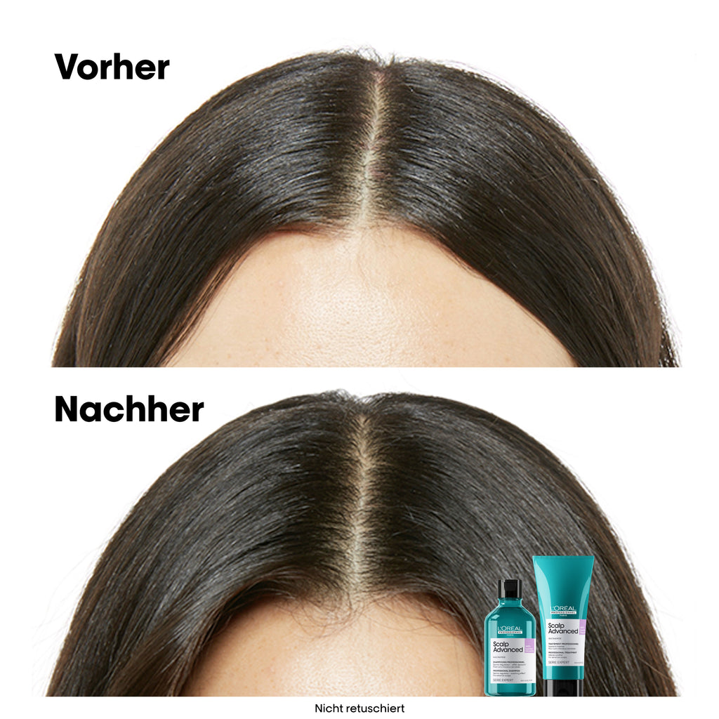 L'Oreal SE Sca A-Discf Shp 300 VB98