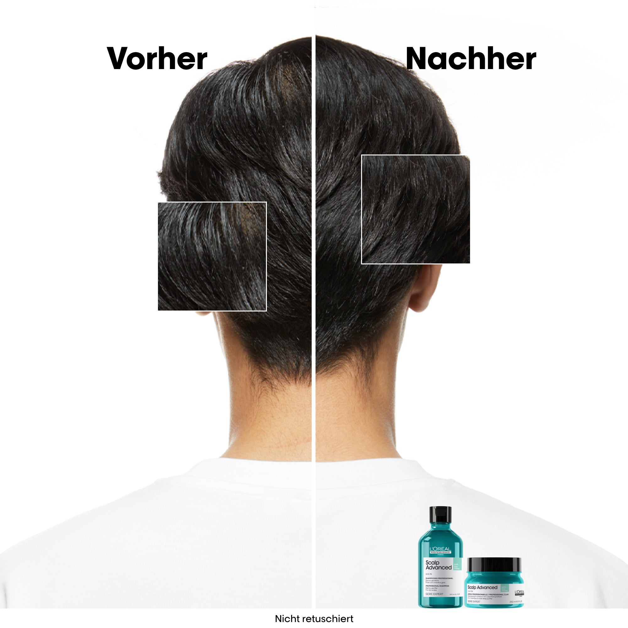 L'Oreal SE Sca A-Oily Msq 250ml I