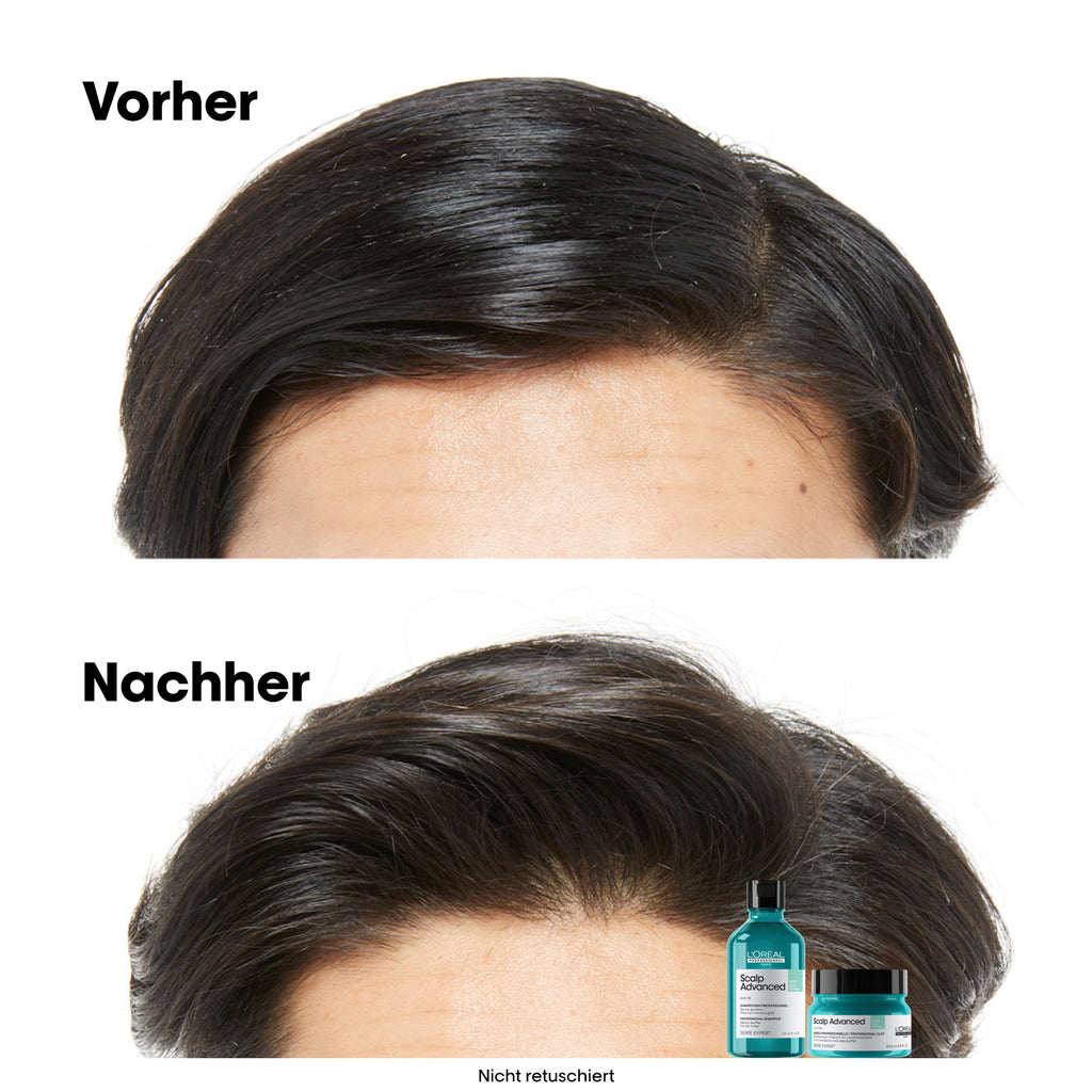 L'Oreal SE Sca A-Oily Msq 250ml I