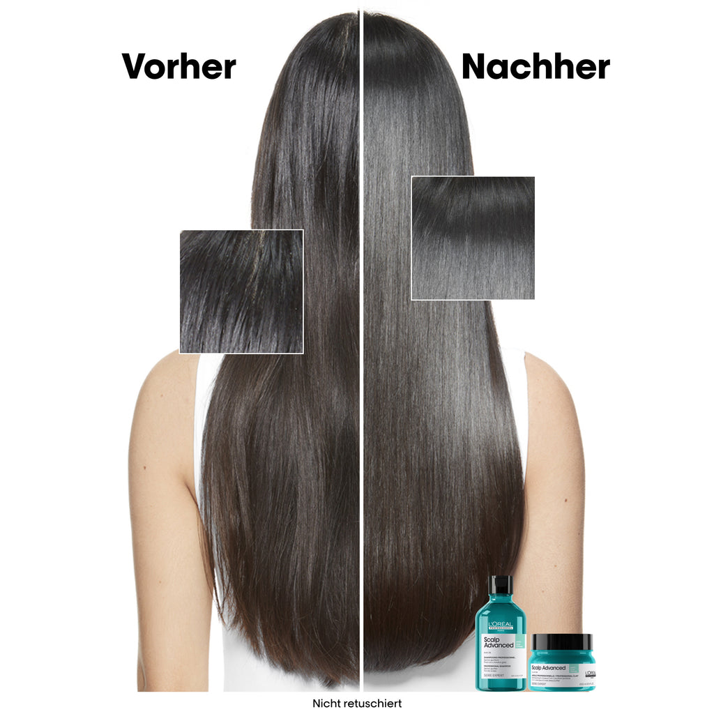 L'Oreal SE Sca A-Oily Msq 250ml I