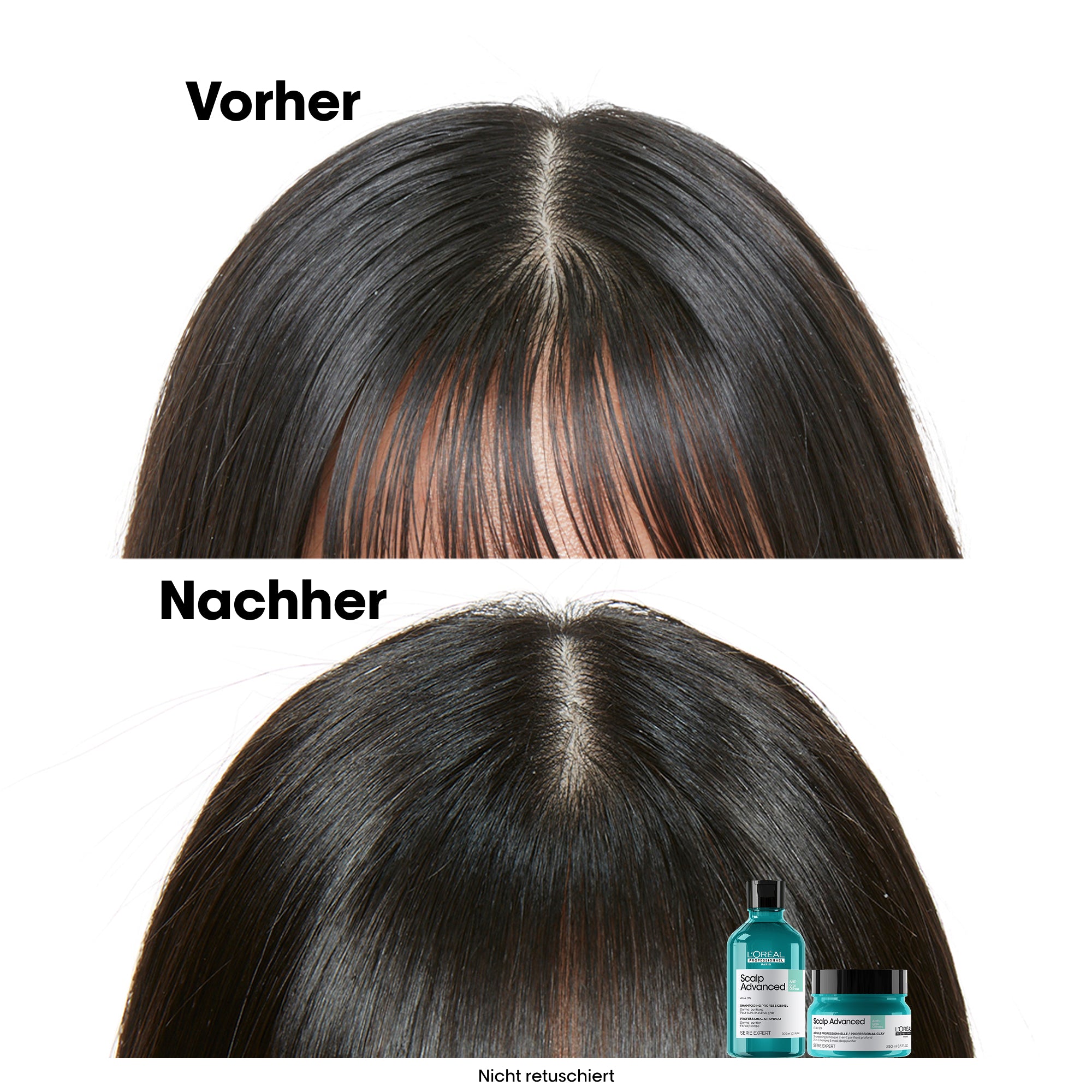 L'Oreal SE Sca A-Oily Msq 250ml I