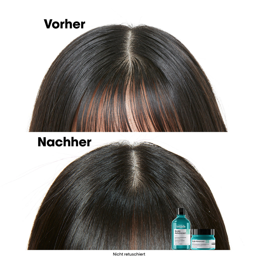 L'Oreal SE Sca A-Oily Msq 250ml I