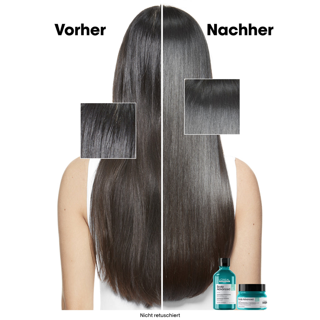 L'Oreal SE Sca A-Oily Shp 300ml VB98
