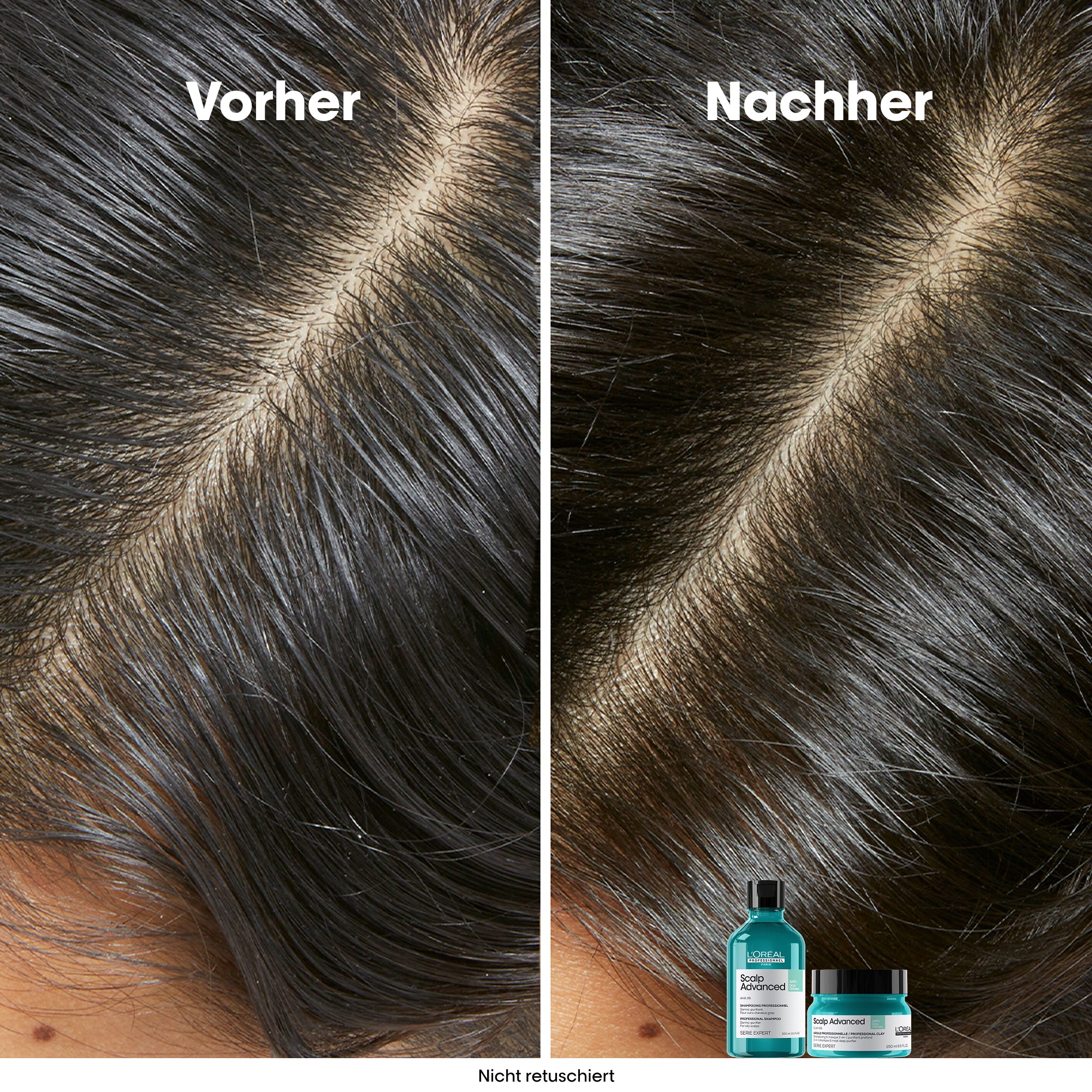 L'Oreal SE Sca A-Oily Shp 300ml VB98