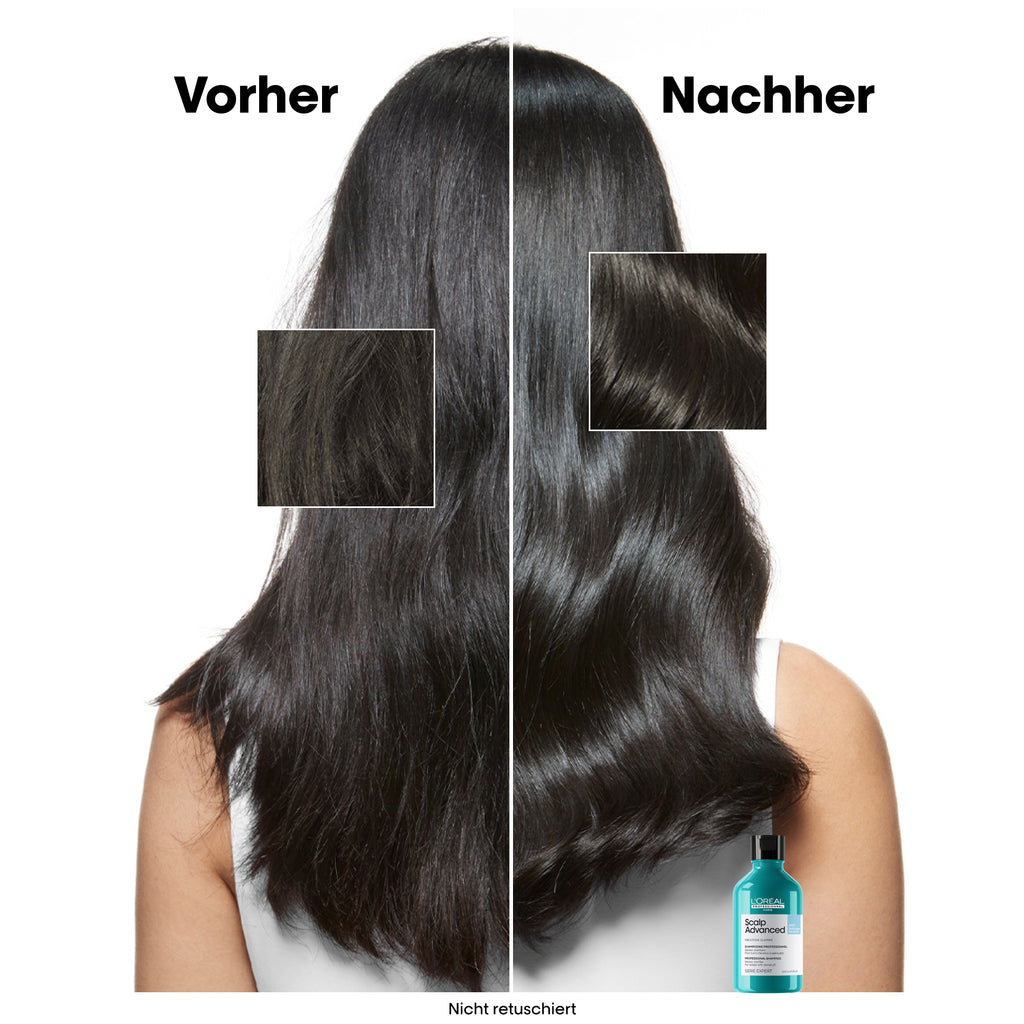 L'Oreal SE Sca A-Dndrf Shp 300 VB98