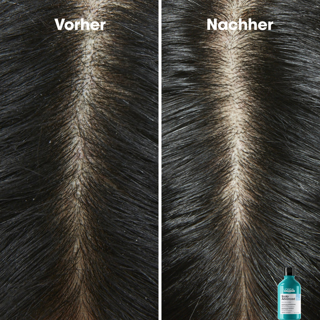 L'Oreal SE Sca A-Dndrf Shp 300 VB98